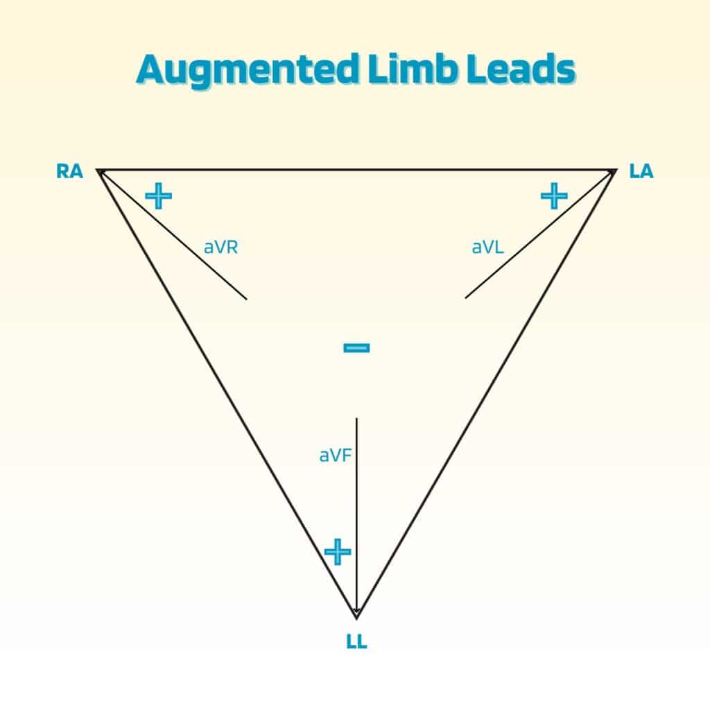 Figure: Augmented Limb Leads